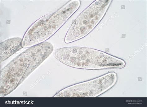  Genus Paramecium: A Microscopic Marvel Exhibiting Both Graceful Movement and Remarkable Voraciousness!